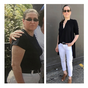 Denise Testimonial Before & After